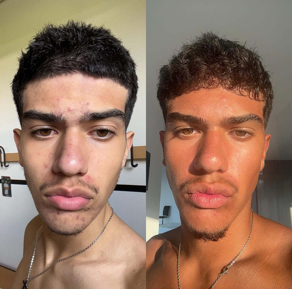 Transformation Hormone